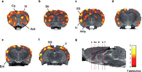 Coronal Brain Section Showing Statistical Parametric Map For Increase