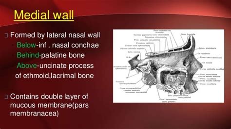 Medial Wall Of Maxillary Sinus