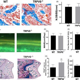 In Trpv Knockout Mice Bone Absorption Was Enhanced And Bone Formation