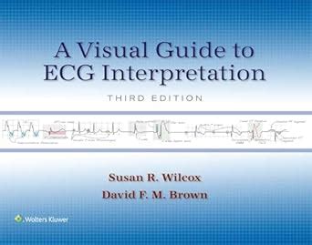 A Visual Guide To Ecg Interpretation Ebook Without Multimedia Ebook