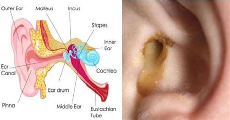 The Most Beneficial Treatments For Ear Infections Health Cautions