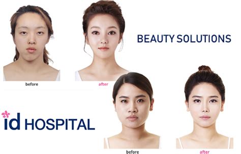 Id Hospital In Korea Prices For Diagnosis And Treatment Reviews Medicglobus