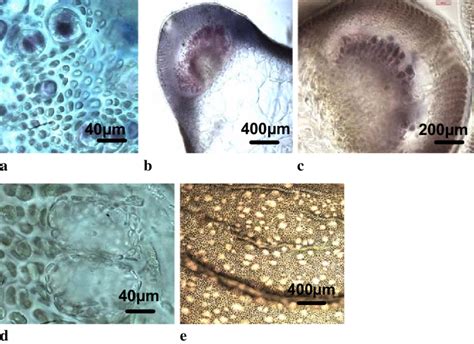 Morphological Features Of Gracilaria Changii A The Tetrasporangia Are