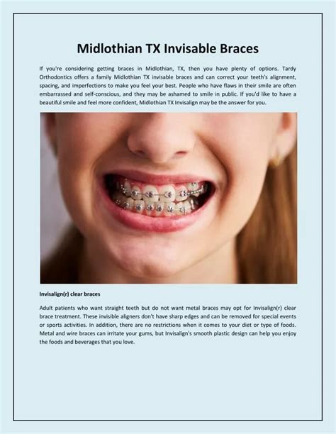 PPT Midlothian TX Invisable Braces PowerPoint Presentation Free