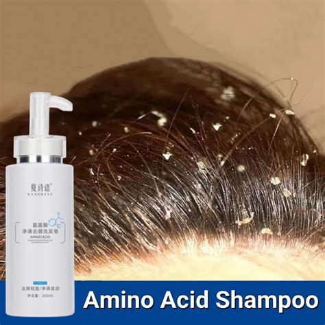 Shampoo Kelemumur Ubat Kulit Kepala Berkuping Syampoo Kelemumur Anti