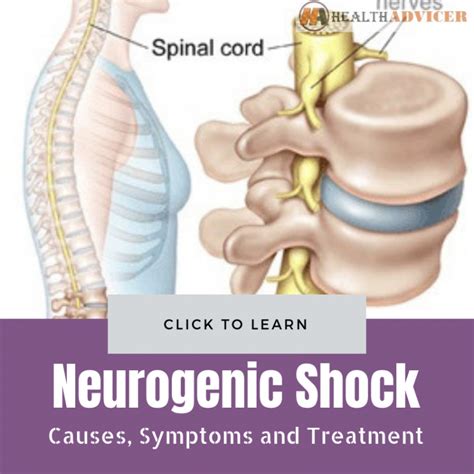 Neurogenic Shock Causes Picture Symptoms And Treatment