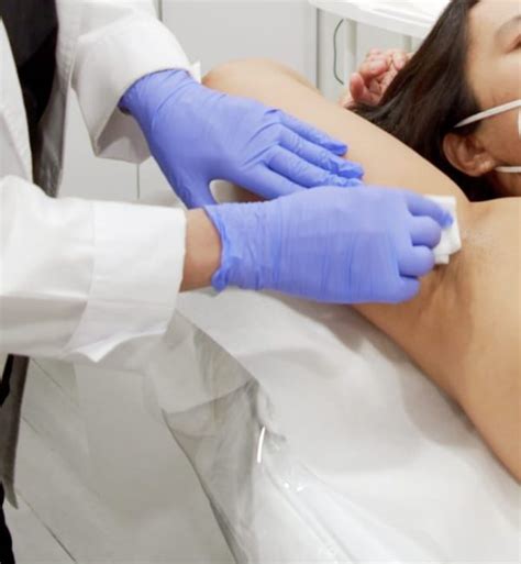 Chemical Peels Treatment In New York Byou Laser Clinic