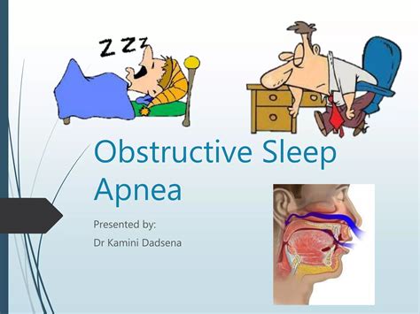 Obstructive Sleep Apnea Ppt