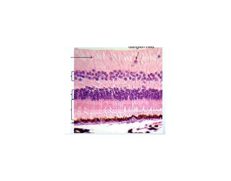 Retina 400x Quiz