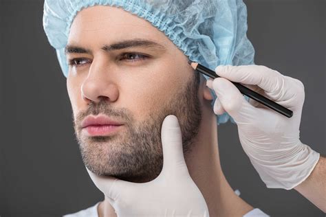 Beard Transplant - Demiderm