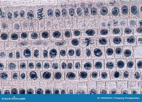 Root Tip Of Onion And Mitosis Cell In The Root Tip Of Onion Under A