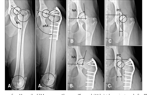 Pdf Effects Of Intertrochanteric Varus Osteotomy On Norberg Angle And