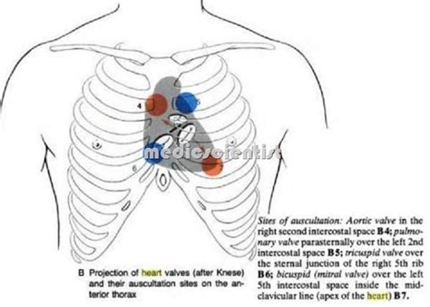 Heart Auscultation Examination