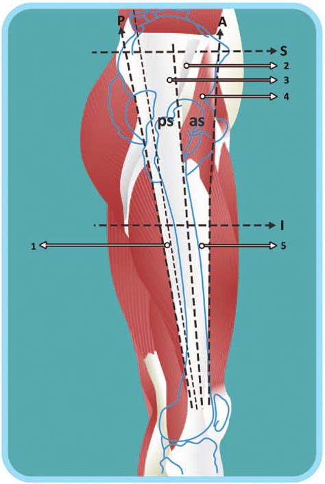 Glutes Diagram Diagram Of The Glutes Gluteus Maximus Physiopedia