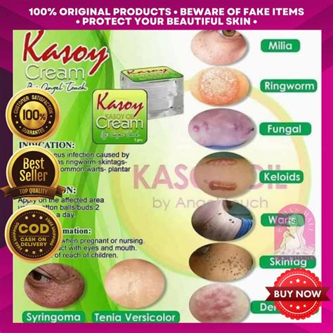 Seamas Original Kasoy Cream Effective Warts Remover Grm Dark