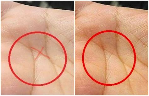 Palmistry X Sign On Palm You Will Surely Become Billionaire Samudrik अगर आप की हथेली पर भी है