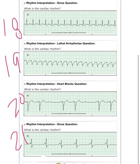 Solved Hello I Need Help With These EKG Questions Thanks D