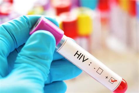 Dezembro Vermelho Testagem De Hiv S Filis E Hepatites Ocorre Nesta