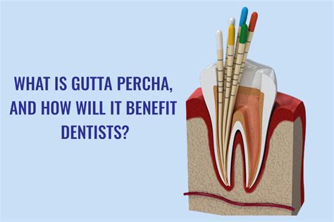 What Is Gutta Percha And How Will It Benefit Dentists Dental Avenue