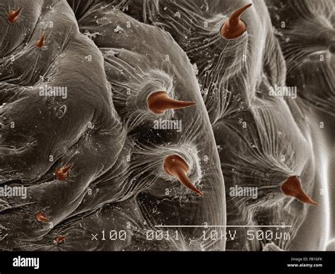 Botfly In Eye