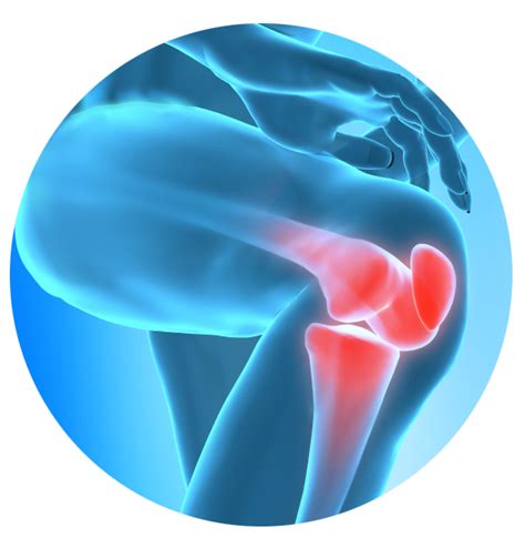 Viscosupplementation Therapy Osteoarthritis Knee Pain Relief Injections