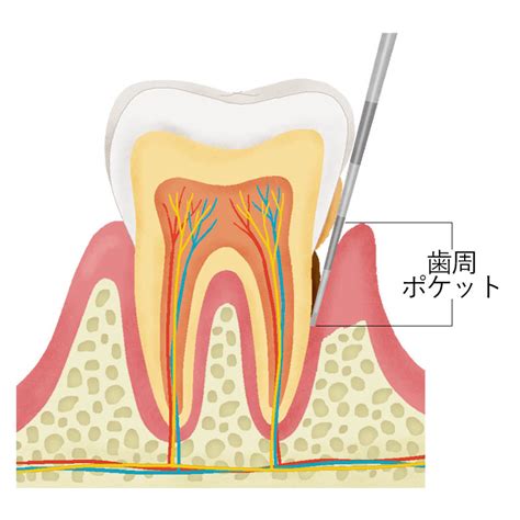 歯周ポケット 歯科用語