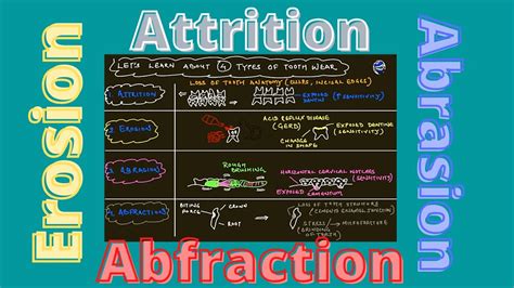 Attrition🟡erosion🔵abrasion🔴abfraction Youtube