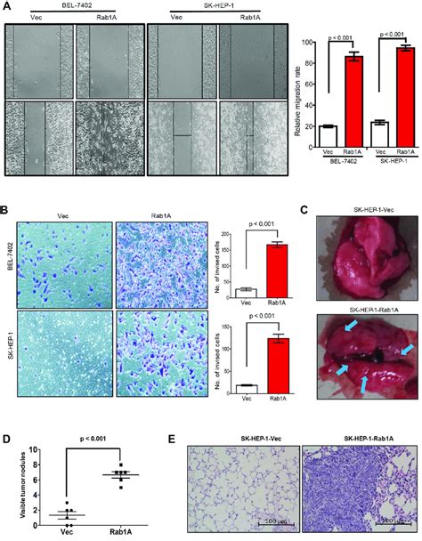 Rab1a Overexpression Promotes Hcc Cell Migration Invasiveness And