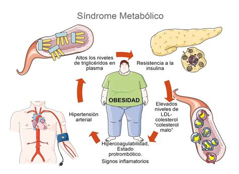 sindrome metabolico Fisiología del Ejercicio