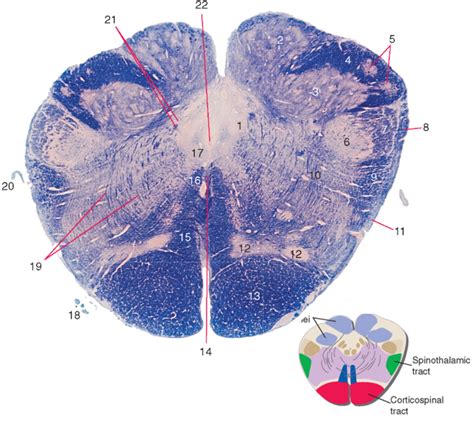 Neuro Lect Caudal Medulla Diagram Quizlet