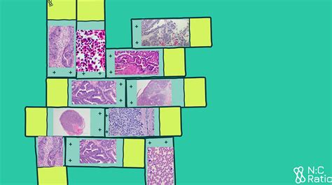 Why The Digital Pathology Revolution Signals Stagnation Of Innovation