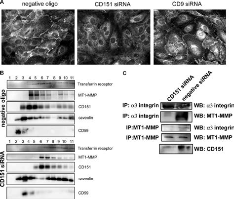 Silencing Cd151 Expression In Huvecs Alters Mt1 Mmp Subcellular