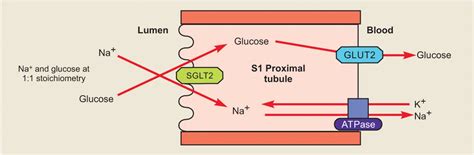 Sodium Glucose Transporter Inhibitors Clinical Guidance 43 OFF