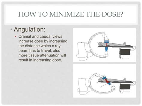 Radiation Safety In Cath Pptx