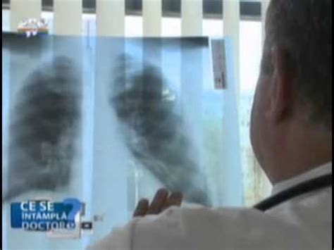 De Ce E Important Sa Faceti Anual O Radiografie Pulmonara YouTube