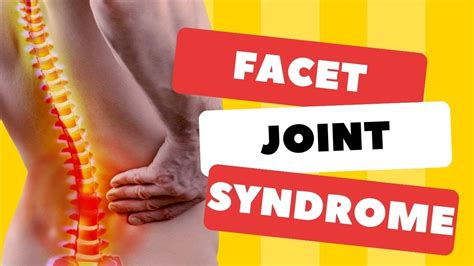 Top 3 Signs Your Back Pain Is Facet Joint Syndrome Symptoms And Signs Youtube