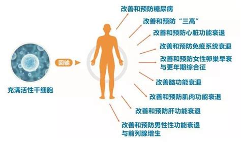 活在“糖尿病大国”必须了解的干细胞疗法 干细胞疗法糖尿病胰岛素并发症治疗技术 健康界