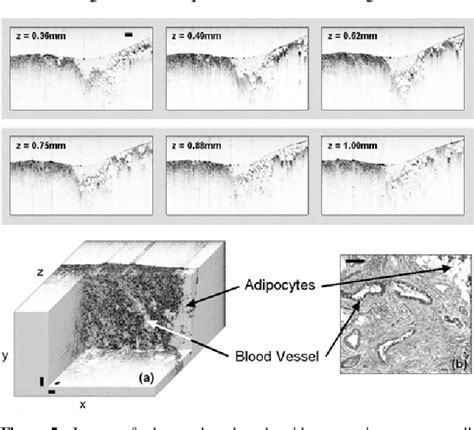 Figure 5 from Optical Biopsy of Lymph Node Morphology using Optical
