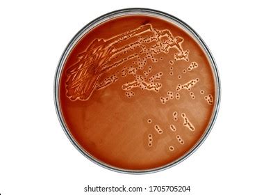 Staphylococcus Aureus Stock Photo 636981727 | Shutterstock