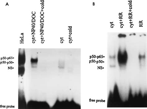 Emsa Of Nf B Activation In Cytoplasmic Extracts Of Endothelial