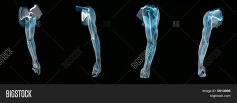 Imagen y foto Anatomí De Una prueba gratis Bigstock