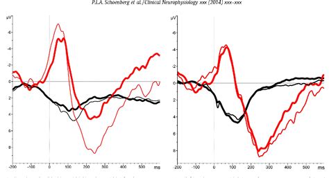 Figure 1 From Effects Of Mindfulness Based Cognitive Therapy On