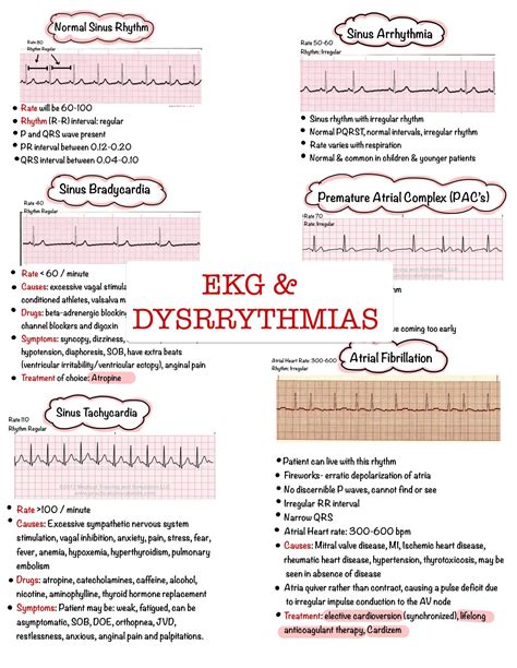 Basic EKG Dysrhythmias Interpretation Nursing Notes 6 Etsy UK In