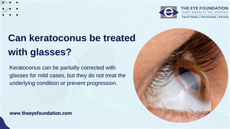 Can Keratoconus Be Treated With Glasses