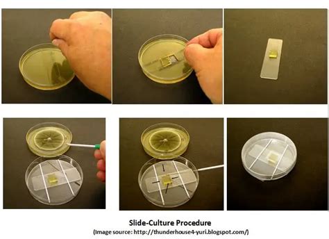 Slide Culture For Fungi Principle Procedure Results Microbe Online