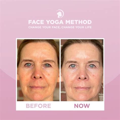 Exercises To Reduce Under Eye Wrinkles Eye Bags And Crow S Feet Reduce