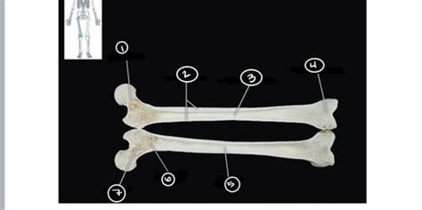 Exercise Overview Of Skeleton Flashcards Quizlet