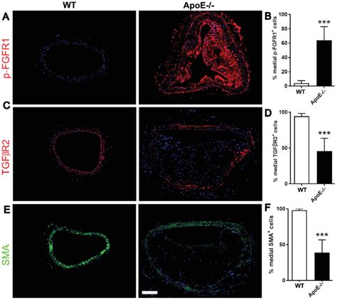 Vsmcs In Hypercholesterolemic Mice Exhibit Activated Fgfr And