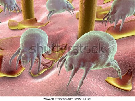 Categoría «dermatophagoides Pteronyssinus De Imágenes Fotos De Stock