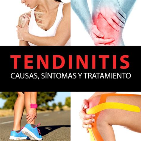 Causas Sintomas Tratamiento Tendinitis Rotuliana Tendinitis Rotuliana